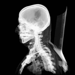 3d CT scan animation